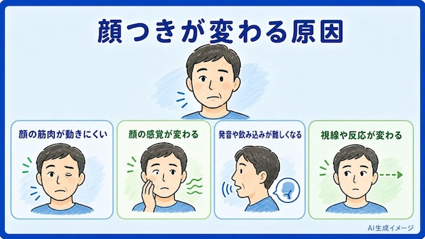 脳梗塞を発症すると顔つきが変わってしまう原因