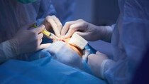 「白内障手術」のタイミングはいつ？ 症状やレンズの種類、術後の回復を医師が解説