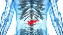 早期の「膵臓がん」は専門病院でも“ほとんど発見されていない”理由を医師が解説