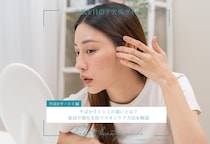 そばかすとシミの違いとは？原因や悪化を防ぐスキンケア方法を解説