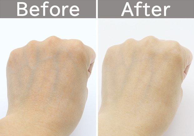 ダイソーのVTS100 リードルセラムを使ったビフォーアフター