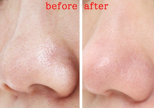 ダイソーの洗顔ブラシのレビュー