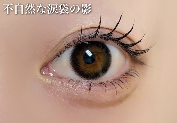 不自然な涙袋の影