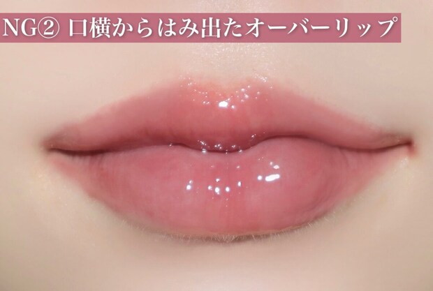 NG②口横からはみ出たオーバーリップ