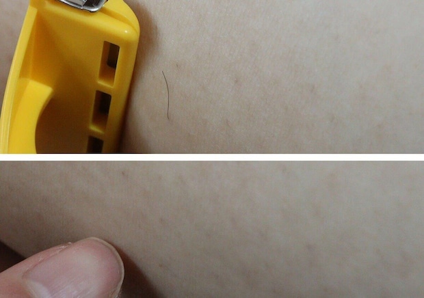 カミソリで腕の毛を剃る前後の肌の比較写真 カミソリで腕の毛を剃る前後の肌の比較写真