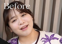 産後の異常なむくみ…心不全で緊急入院「体重80㎏に。脂肪とかじゃなく水分で10㎏だった」ゆうこすさんの産後ダイエット