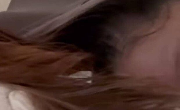 睡眠中、急に頭皮が痛くなってきて…… “まさかのワケ”に驚きの声「こんな感じになるんだ」「びっくり」