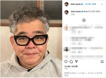 薄毛に悩むベテラン芸人が増毛で大変身→ 思い切ったパーマに「えっ!?」「めっちゃ生えてるやん！」と驚きの声