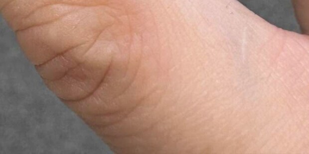 2歳息子が突然の悲鳴→ママの指先を見ると…… 「ヒイィィィィ」衝撃の光景に「なにこれっ!」「絶対無理」