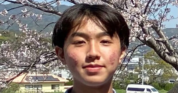 「ニキビ爆発」してた中2男子→6年後……「えっぐ」　青学生になった“現在の姿”に衝撃「そりゃ誰も勝てんわ」「かっけぇぇぇ!!!」