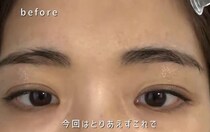 【画像】ビフォーアフターを見る