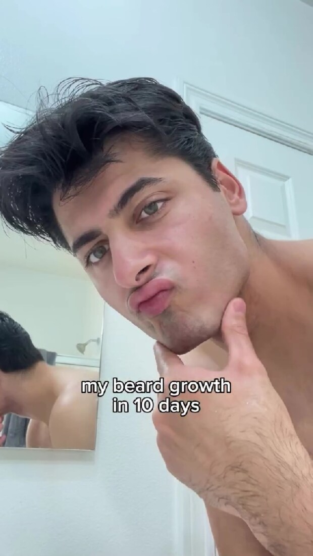 ヒゲ剃りしたばかりの男性→10日後……　別人レベルのビフォーアフターに「めっちゃイケメン」「すごくセクシー」　【海外】