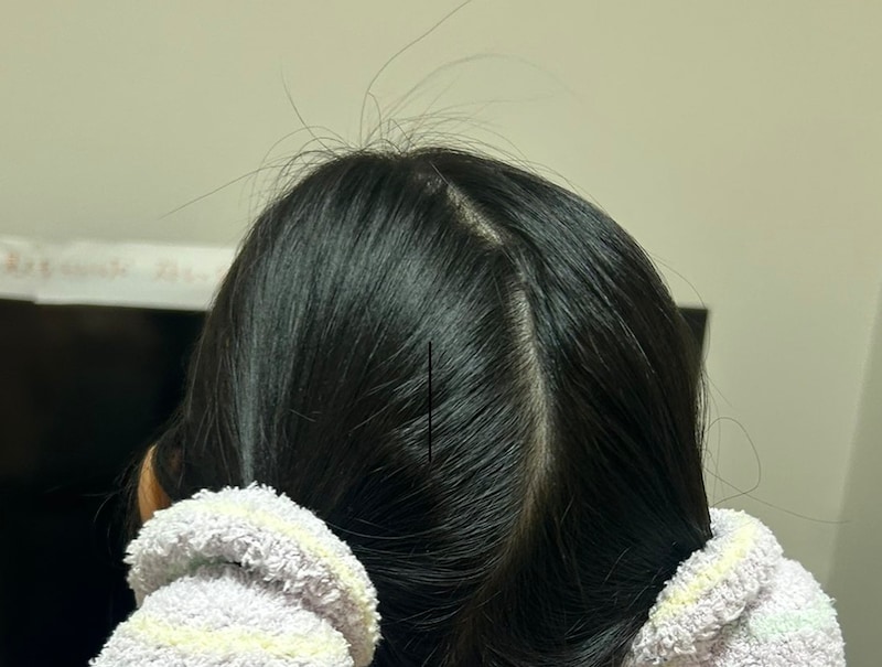 ママが小2娘の髪に巻いたまさかのアイテム→翌朝ほどくと……　驚きの光景が480万表示「えっ、本当に!?」「やってみたいかも」