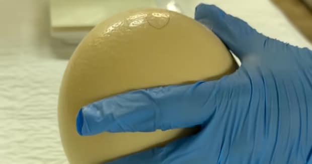 予定日にふ化しなかったダチョウの卵、ライトを当てると……「こんな卵から！？」　まさかの光景に「無事でありますように」