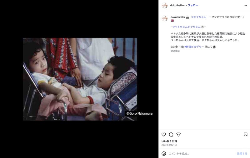 元“ベトちゃんドクちゃん”、手術から37年経過した現在…… 生まれた双子に“日本にまつわる名前”付け感謝の念「皆さまのおかげで今日の私がある」