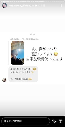 Matt、さらりと「鼻がっつり整形してます」　きっかけはファンからのコメント