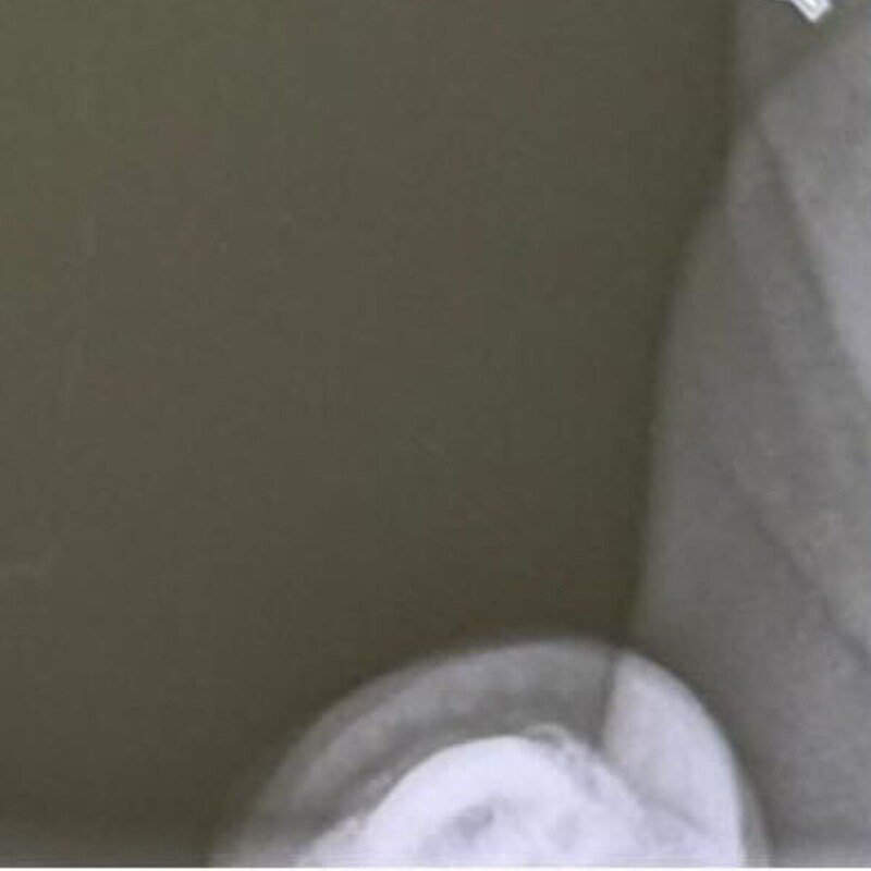 9カ月赤ちゃんと病院へ→レントゲンを撮ったら……　「えっすごい」予想外すぎる1枚にママ仰天「宇宙空間みたい」