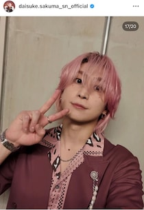 Snow Man佐久間大介「この黒いのなんだ？」　突然“謎のアザ”公開し240万表示　「ああああ…!!!」「これ昔よく出来てたやつだ！」と大注目