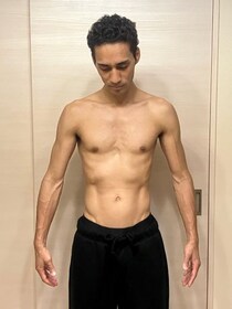 白血病の闘病＆入院中に体重「7キロ減」　衝撃告白したアレクの“弟的存在”タレント「胃下垂だから太りにくいんだと」「食欲も減って」
