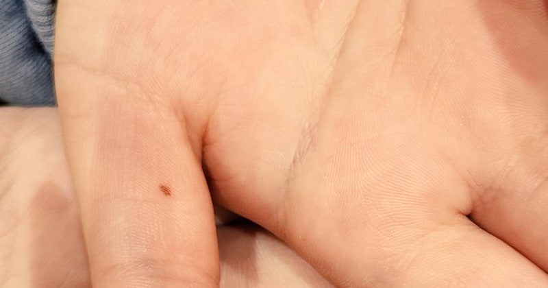 母と同じ位置に「ほくろ」を見つけた8歳息子→“まさかの一言”が100万表示　「爆笑」「なんて愛おしい」