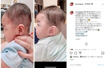 稲垣早希、0歳息子の“ヘルメット治療”前後の姿を公開　頭部の形が大幅改善に「思い切ってやって良かった」