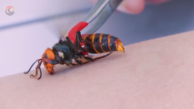 オオスズメバチに刺された直後→左腕がとんでもないことに……　「もはやレベルが違う」「死ななくて良かった」と340万再生【海外】