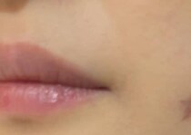 ニキビ跡のシミが気になる女性、アイライナーを使うと……「ナシですか！？」→　まさかの姿に「新発想」「ジョースター家の方ですか？」