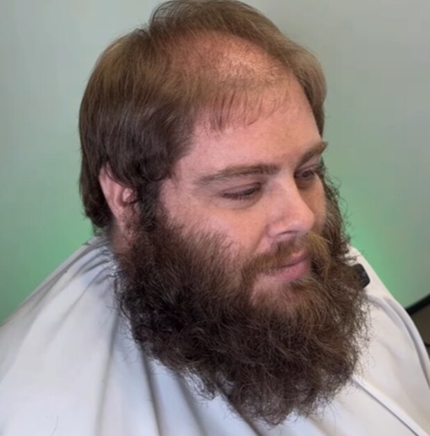 薄毛に悩む男性→プロが思い切ってヘアカットすると…… 「ハンサムが隠れてた」予想を超える“逆転の発想”が248万再生【海外】