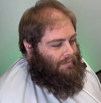 薄毛に悩む男性→プロが思い切ってヘアカットすると……　「ハンサムが隠れてた」予想を超える“逆転の発想”が248万再生【海外】