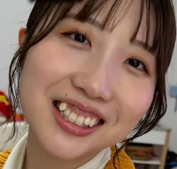 20代女性「八重歯がチャームポイントだと思っていた」→矯正を決意して1年後……　驚きの姿に「可愛いから綺麗に」「すっごい優しい顔になった」