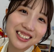 20代女性「八重歯がチャームポイントだと思っていた」→矯正を決意して1年後……　驚きの姿に「可愛いから綺麗に」「すっごい優しい顔になった」