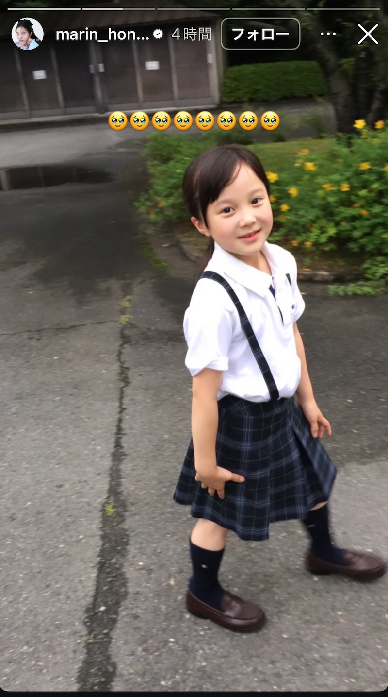 天使のような笑顔の妹が高校生に→卒業式のまさかの姿にSNS驚き「まじか」「家庭環境も遺伝子も強すぎる」【本田真凜・本田紗来】