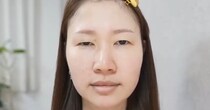 【画像】ビフォーアフターを見る