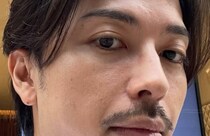 【完全無加工】30代男性が“本気のスキンケア”だけで……　「全然違う！！」信じられない若返りに反響