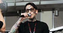 「別人すぎてスゴい！」　BreakingDown瓜田純士、“キレイになった姿”にくぎ付け　450万回以上見られた“若返り顔”に「誰ですか」「もはや違和感」