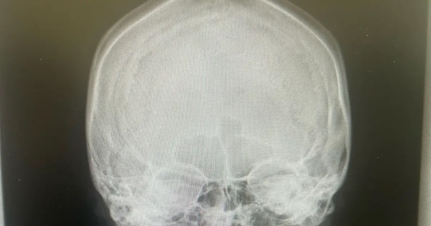 3児ママ、鼻のレントゲンを撮ったら……「ばりギャルな骸骨になったwww」　医師と爆笑した“まさかの光景”が120万再生