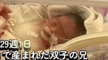妊娠29週1日、“ほぼ羊水のない状態”で生まれた双子→「生存が難しい」と言われて4カ月後……　“現在の姿”に「たくさん幸せになるんだよ」