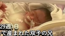 【画像】29週1日で生まれた双子の4カ月後