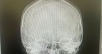 3児ママ、鼻のレントゲンを撮ったら……「ばりギャルな骸骨になったwww」　医師と爆笑した“まさかの光景”が120万再生