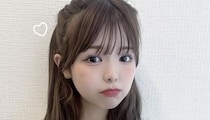 “今日好き”折田涼夏「顔のほぼ全部損傷」、交通事故時の“悲惨な状態”明かす→顔の違和感について「想像以上だった……」「話だけでも怖い」