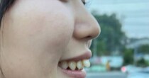 女性が“100万円の歯列矯正”に挑戦→1年後……「すごーい！」　驚きの変化に「同じ人？」「びっくり！」