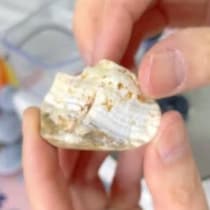 【画像】信じられないビフォーアフター
