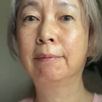 「おばあちゃん」と言われた54歳女性→若返りを決意し1年後……驚きの現在に「毛穴無い！」「お肌も顔立ちも綺麗」