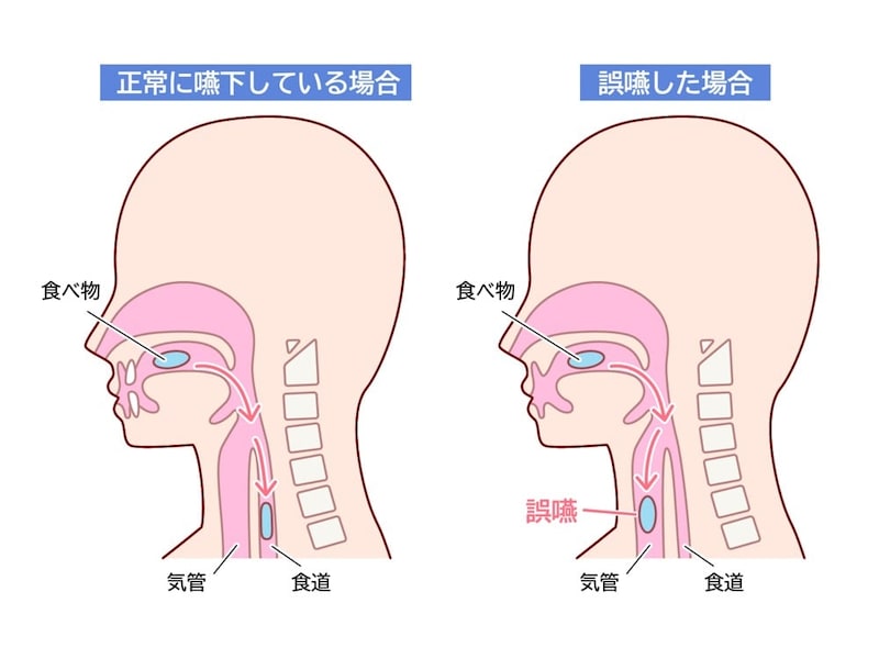 誤嚥の仕組み