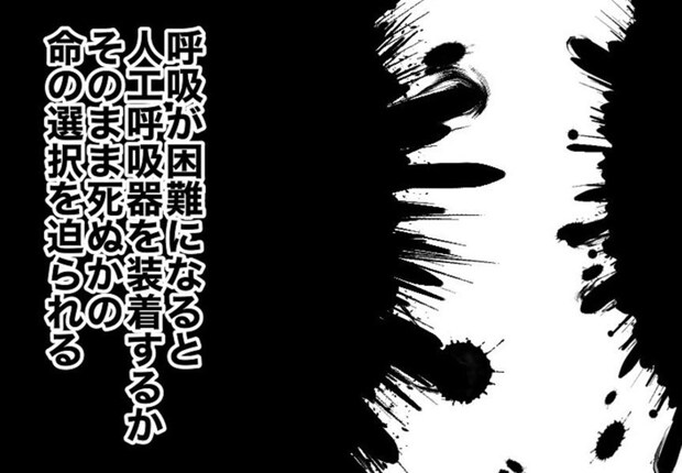 「難病・ALS」医師の告知で崩壊…絶望の中に見つけた「希望」