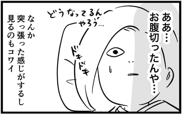 3児母が盲腸で【緊急手術】→真夜中の腹痛から術後までをリアルにつづる体験漫画