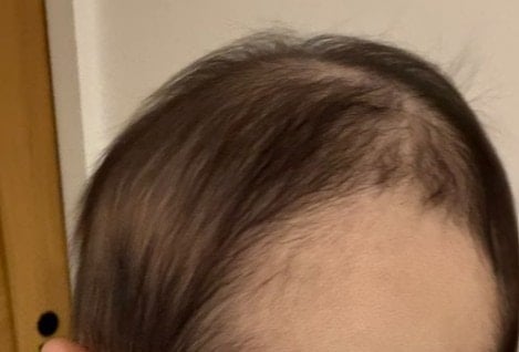 母「世界一かわいい髪型」→赤ちゃんの後頭部写真に2万いいね「リプ欄至福」「かわいいが連鎖しとる」