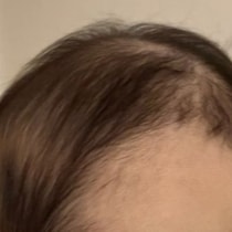 母「世界一かわいい髪型」→赤ちゃんの後頭部写真に2万いいね「リプ欄至福」「かわいいが連鎖しとる」