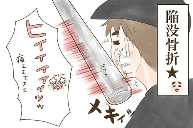 「俺も骨折経験ある」パパの小学生時代のケガが衝撃的すぎる|長男ひかるが3歳の時骨折した話