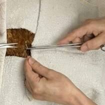 【2万いいね】心臓外科医パパ、幼い娘と二人三脚で手術に挑んだ結果が温かい